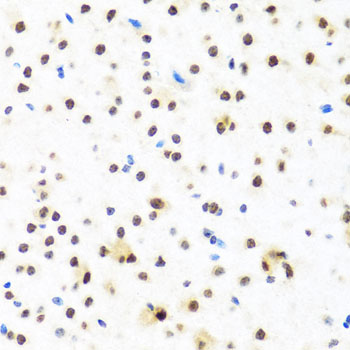 FUBP1 Antibody - Immunohistochemistry of paraffin-embedded mouse brain tissue.