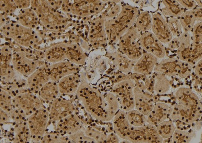 FUBP1 Antibody - 1:100 staining rat kidney tissue by IHC-P. The sample was formaldehyde fixed and a heat mediated antigen retrieval step in citrate buffer was performed. The sample was then blocked and incubated with the antibody for 1.5 hours at 22°C. An HRP conjugated goat anti-rabbit antibody was used as the secondary.