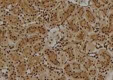 FUBP1 Antibody - 1:100 staining rat kidney tissue by IHC-P. The sample was formaldehyde fixed and a heat mediated antigen retrieval step in citrate buffer was performed. The sample was then blocked and incubated with the antibody for 1.5 hours at 22°C. An HRP conjugated goat anti-rabbit antibody was used as the secondary.