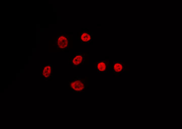 FUBP1 Antibody - Staining HeLa cells by IF/ICC. The samples were fixed with PFA and permeabilized in 0.1% Triton X-100, then blocked in 10% serum for 45 min at 25°C. The primary antibody was diluted at 1:200 and incubated with the sample for 1 hour at 37°C. An Alexa Fluor 594 conjugated goat anti-rabbit IgG (H+L) Ab, diluted at 1/600, was used as the secondary antibody.