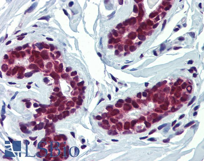 FUBP3 Antibody - Anti-FUBP3 / FBP3 antibody IHC of human breast. Immunohistochemistry of formalin-fixed, paraffin-embedded tissue after heat-induced antigen retrieval. Antibody concentration 5 ug/ml.  This image was taken for the unconjugated form of this product. Other forms have not been tested.