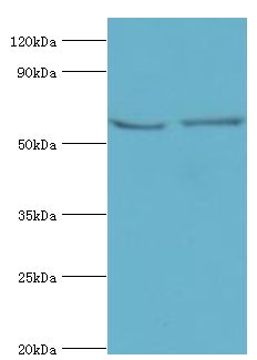 FUBP3 Antibody - Western blot. All lanes: Far upstream element-binding protein 3 antibody at 2 ug/ml. Lane 1: HeLa whole cell lysate. Lane 2: HepG2 whole cell lysate. secondary Goat polyclonal to rabbit at 1:10000 dilution. Predicted band size: 62 kDa. Observed band size: 62 kDa.