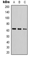 FUBP3 Antibody - Western blot analysis of FUBP3 expression in HEK293T (A); HepG2 (B); MCF7 (C) whole cell lysates.