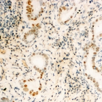 FUBP3 Antibody - Immunohistochemical analysis of FUBP3 staining in human kidney formalin fixed paraffin embedded tissue section. The section was pre-treated using heat mediated antigen retrieval with sodium citrate buffer (pH 6.0). The section was then incubated with the antibody at room temperature and detected with HRP and DAB as chromogen. The section was then counterstained with hematoxylin and mounted with DPX.