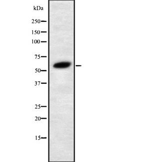 FUBP3 Antibody - Western blot analysis FBP3 using COLO205 whole cells lysates