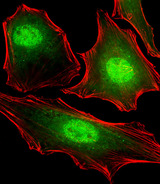 FUBP3 Antibody - Fluorescent image of HeLa cells stained with FUBP3 Antibody. Antibody was diluted at 1:25 dilution. An Alexa Fluor 488-conjugated goat anti-mouse lgG at 1:400 dilution was used as the secondary antibody (green). Cytoplasmic actin was counterstained with Alexa Fluor 555 conjugated with Phalloidin (red).