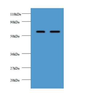 FUCA2 Antibody - Western blot of Plasma alpha-L-fucosidase antibody at 2 ug/ml. Lane 1: EC109 whole cell lysate. Lane 2: 293T whole cell lysate. Secondary: Goat polyclonal to rabbit IgG at 1:10000 dilution. Predicted band size: 51 kDa. Observed band size: 51 kDa.  This image was taken for the unconjugated form of this product. Other forms have not been tested.