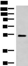 FUCA2 Antibody - Western blot analysis of Mouse heart tissue lysate  using FUCA2 Polyclonal Antibody at dilution of 1:1000