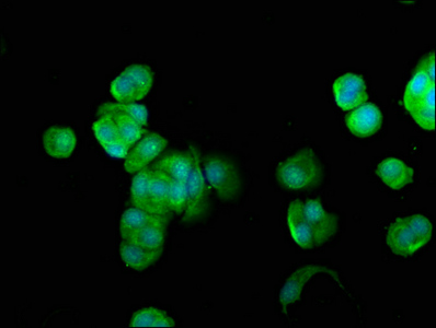 FUK Antibody - Immunofluorescence staining of MCF-7 cells at a dilution of 1:100, counter-stained with DAPI. The cells were fixed in 4% formaldehyde, permeabilized using 0.2% Triton X-100 and blocked in 10% normal Goat Serum. The cells were then incubated with the antibody overnight at 4 °C.The secondary antibody was Alexa Fluor 488-congugated AffiniPure Goat Anti-Rabbit IgG (H+L) .
