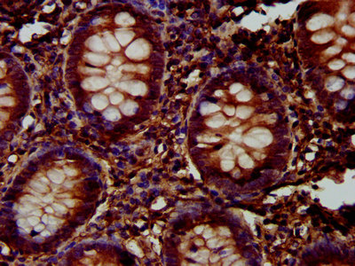 FUK Antibody - Immunohistochemistry image at a dilution of 1:300 and staining in paraffin-embedded human appendix tissue performed on a Leica BondTM system. After dewaxing and hydration, antigen retrieval was mediated by high pressure in a citrate buffer (pH 6.0) . Section was blocked with 10% normal goat serum 30min at RT. Then primary antibody (1% BSA) was incubated at 4 °C overnight. The primary is detected by a biotinylated secondary antibody and visualized using an HRP conjugated SP system.