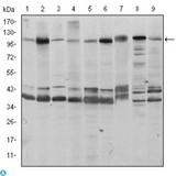 FUK Antibody - Western Blot (WB) analysis using Fucokinase Monoclonal Antibody against HeLa (1), HepG2 (2), Jurkat (3), A431 (4), HEK293 (5), MCF-7 (6), PC-12 (7), Cos7 (8), and NIH/3T3 (9) cell lysate.