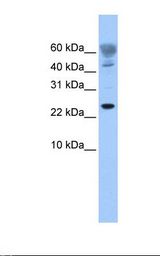 FUNDC1 Antibody - 721_B cell lysate. Antibody concentration: 1.0 ug/ml. Gel concentration: 10-20%.  This image was taken for the unconjugated form of this product. Other forms have not been tested.