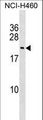 FUNDC1 Antibody - FUNDC1 Antibody western blot of NCI-H460 cell line lysates (35 ug/lane). The FUNDC1 antibody detected the FUNDC1 protein (arrow).