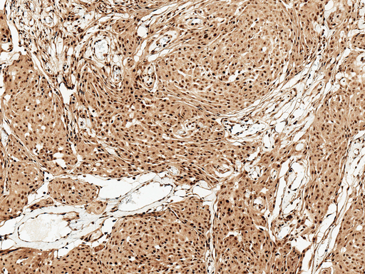 FUNDC1 Antibody - Immunohistochemistry analysis using Rabbit Anti-FUNDC1 Polyclonal Antibody. Tissue: Brain. Species: Human. Fixation: Formalin Fixed Paraffin-Embedded. Primary Antibody: Rabbit Anti-FUNDC1 Polyclonal Antibody  at 1:50 for 30 min at RT. Counterstain: Hematoxylin. Magnification: 10X. HRP-DAB Detection.