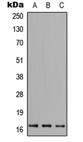 FUNDC1 Antibody - Western blot analysis of FUNDC1 expression in HEK293T (A); NS-1 (B); PC12 (C) whole cell lysates.
