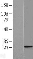 FUNDC2 Protein - Western validation with an anti-DDK antibody * L: Control HEK293 lysate R: Over-expression lysate