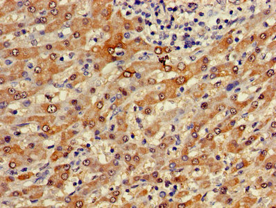 FUOM / C10orf125 Antibody - Immunohistochemistry of paraffin-embedded human liver tissue using FUOM Antibody at dilution of 1:100