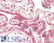 FURIN Antibody - Human Placenta: Formalin-Fixed, Paraffin-Embedded (FFPE)
