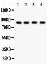 FURIN Antibody - Furin antibody Western blot. All lanes: Anti Furin at 0.5 ug/ml. Lane 1: HeLa Whole Cell Lysate at 40 ug. Lane 2: MCF-7 Whole Cell Lysate at 40 ug. Lane 3: Colo320 Whole Cell Lysate at 40 ug. Lane 4: SW620 Whole Cell Lysate at 40 ug. Predicted band size: 87 kD. Observed band size: 87 kD.
