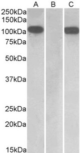 FURIN Antibody - HEK293 lysate (10ug protein in RIPA buffer) overexpressing Human Furin with C-terminal MYC tag probed with antibody (1ug/ml) in Lane A and probed with anti-MYC Tag (1/1000) in lane C. Mock-transfected HEK293 probed with antibody (1ug/ml) in Lane B. Primary
