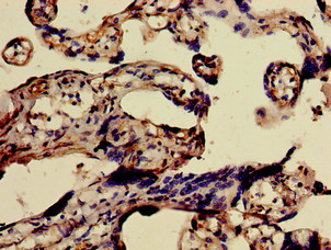 FURIN Antibody - Immunohistochemistry of paraffin-embedded human placenta tissue using FURIN Antibody at dilution of 1:100