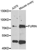 FURIN Antibody - Western blot analysis of extracts of various cell lines, using FURIN antibody at 1:1000 dilution. The secondary antibody used was an HRP Goat Anti-Rabbit IgG (H+L) at 1:10000 dilution. Lysates were loaded 25ug per lane and 3% nonfat dry milk in TBST was used for blocking. An ECL Kit was used for detection and the exposure time was 90s.