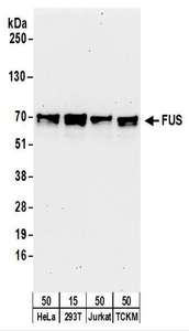 FUS / TLS Antibody - Detection of Human and Mouse FUS by Western Blot. Samples: Whole cell lysate from HeLa (50 ug), 293T (50 ug), Jurkat (50 ug) and TCKM (50 ug) cells. Antibodies: Affinity purified rabbit anti-FUS antibody used for WB at 0.1 ug/ml. Detection: Chemiluminescence with an exposure time of 3 minutes.