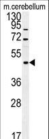FUS / TLS Antibody - FUS Antibody western blot of mouse cerebellum tissue lysates (15 ug/lane). The FUS antibody detected FUS protein (arrow).