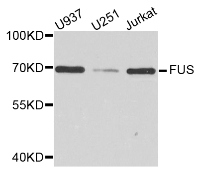 FUS / TLS Antibody - Western blot analysis of extract of various cells.