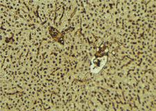 FUS / TLS Antibody - 1:100 staining mouse liver tissue by IHC-P. The sample was formaldehyde fixed and a heat mediated antigen retrieval step in citrate buffer was performed. The sample was then blocked and incubated with the antibody for 1.5 hours at 22°C. An HRP conjugated goat anti-rabbit antibody was used as the secondary.