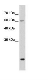 FUS / TLS Antibody - HepG2 Cell Lysate.  This image was taken for the unconjugated form of this product. Other forms have not been tested.