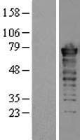 FUS / TLS Protein - Western validation with an anti-DDK antibody * L: Control HEK293 lysate R: Over-expression lysate