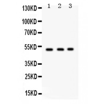 FUT1 / HSC Antibody - FUT1 antibody Western blot. All lanes: Anti FUT1 at 0.5 ug/ml. Lane 1: Rat Kidney Tissue Lysate at 50 ug. Lane 2: SW620 Whole Cell Lysate at 40 ug. Lane 3: A549 Whole Cell Lysate at 40 ug. Predicted band size: 50 kD. Observed band size: 50 kD.