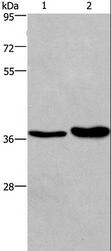 FUT1 / HSC Antibody - Western blot analysis of Human testis tissue and transitional cell carcinoma of bladder tissue, using FUT1 Polyclonal Antibody at dilution of 1:250.