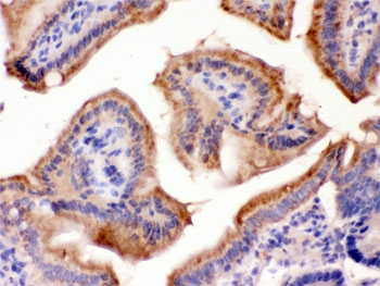 FUT1 / HSC Antibody