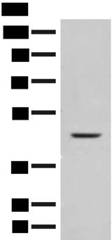 FUT10 Antibody - Western blot analysis of Mouse liver tissue lysate  using FUT10 Polyclonal Antibody at dilution of 1:450