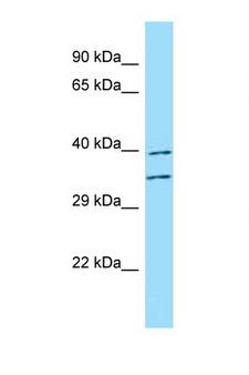 FUT3 Antibody - FUT3 / CD174 antibody Western blot of Fetal Kidney lysate. Antibody concentration 1 ug/ml.  This image was taken for the unconjugated form of this product. Other forms have not been tested.