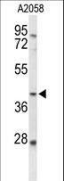 FUT3 Antibody - Western blot of FUT3 Antibody in A2058 cell line lysates (35 ug/lane). FUT3 (arrow) was detected using the purified antibody.