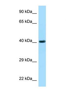 FUT3 Antibody - FUT3 / CD174 antibody Western blot of 721_B Cell lysate. Antibody concentration 1 ug/ml.  This image was taken for the unconjugated form of this product. Other forms have not been tested.