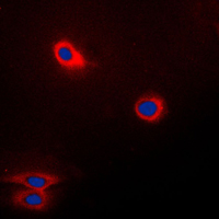 FUT3 Antibody - Immunofluorescent analysis of CD174 staining in Raw264.7 cells. Formalin-fixed cells were permeabilized with 0.1% Triton X-100 in TBS for 5-10 minutes and blocked with 3% BSA-PBS for 30 minutes at room temperature. Cells were probed with the primary antibody in 3% BSA-PBS and incubated overnight at 4 C in a humidified chamber. Cells were washed with PBST and incubated with a DyLight 594-conjugated secondary antibody (red) in PBS at room temperature in the dark. DAPI was used to stain the cell nuclei (blue).