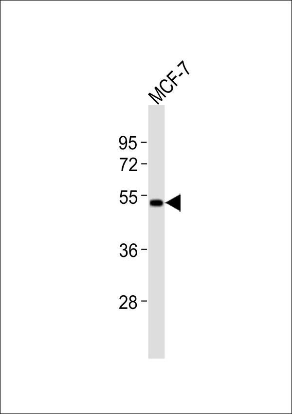 FUT3 Antibody - Anti-CD174 Antibody at 1:1000 dilution + MCF-7 whole cell lysates Lysates/proteins at 20 ug per lane. Secondary Goat Anti-Rabbit IgG, (H+L),Peroxidase conjugated at 1/10000 dilution Predicted band size : 42 kDa Blocking/Dilution buffer: 5% NFDM/TBST.