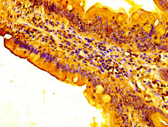FUT3 Antibody - Immunohistochemistry image at a dilution of 1:300 and staining in paraffin-embedded human small intestine tissue performed on a Leica BondTM system. After dewaxing and hydration, antigen retrieval was mediated by high pressure in a citrate buffer (pH 6.0) . Section was blocked with 10% normal goat serum 30min at RT. Then primary antibody (1% BSA) was incubated at 4 °C overnight. The primary is detected by a biotinylated secondary antibody and visualized using an HRP conjugated SP system.