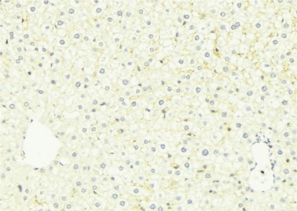 FUT3 Antibody - 1:100 staining mouse liver tissue by IHC-P. The sample was formaldehyde fixed and a heat mediated antigen retrieval step in citrate buffer was performed. The sample was then blocked and incubated with the antibody for 1.5 hours at 22°C. An HRP conjugated goat anti-rabbit antibody was used as the secondary.