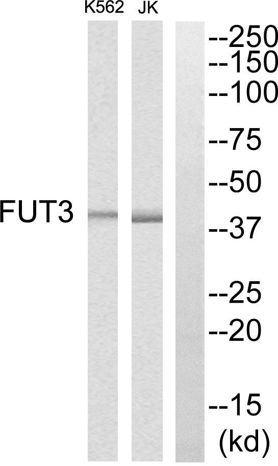 FUT3 Antibody - Peptide - + Immunohistochemistry analysis of paraffin-embedded human colon carcinoma tissue, using MRPS7 antibody.
