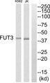FUT3 Antibody - Peptide - + Immunohistochemistry analysis of paraffin-embedded human colon carcinoma tissue, using MRPS7 antibody.