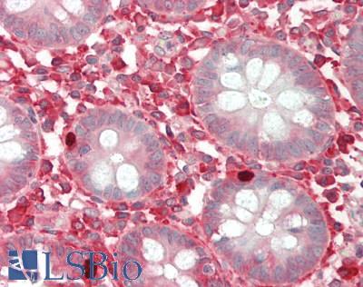 FUT4 / CD15 Antibody - Human Colon: Formalin-Fixed, Paraffin-Embedded (FFPE).  This image was taken for the unconjugated form of this product. Other forms have not been tested.