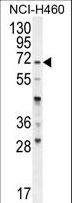 FUT4 / CD15 Antibody - FUT4 Antibody western blot of NCI-H460 cell line lysates (35 ug/lane). The FUT4 antibody detected the FUT4 protein (arrow).