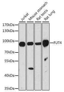 FUT4 / CD15 Antibody - Western blot - FUT4 Polyclonal Antibody