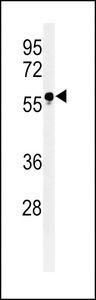 FUT6 Antibody - Western blot of FUT6 Antibody in HL-60 cell line lysates (35 ug/lane). FUT6 (arrow) was detected using the purified antibody.