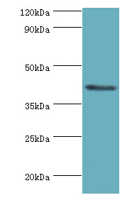 FUT6 Antibody - Western blot. All lanes: FUT6 antibody at 4 ug/ml+HeLa whole cell lysate. Secondary antibody: Goat polyclonal to rabbit at 1:10000 dilution. Predicted band size: 42 kDa. Observed band size: 42 kDa Immunohistochemistry.